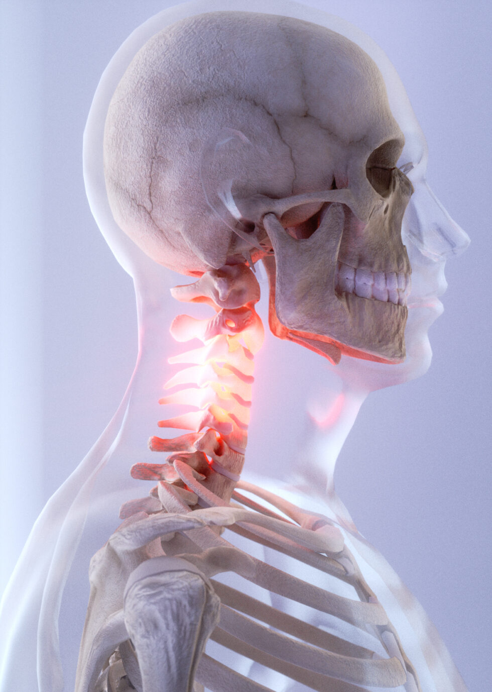 illustration_médicale_3D_Anatomie_Inflammation_Cervicales_squelette_Anne-Christel _Rolling